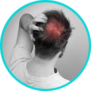 hair loss treatment