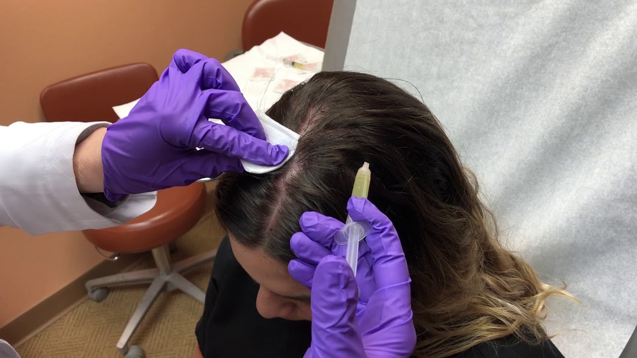 Hair Loss Treatment. Hair Loss Treatment.
