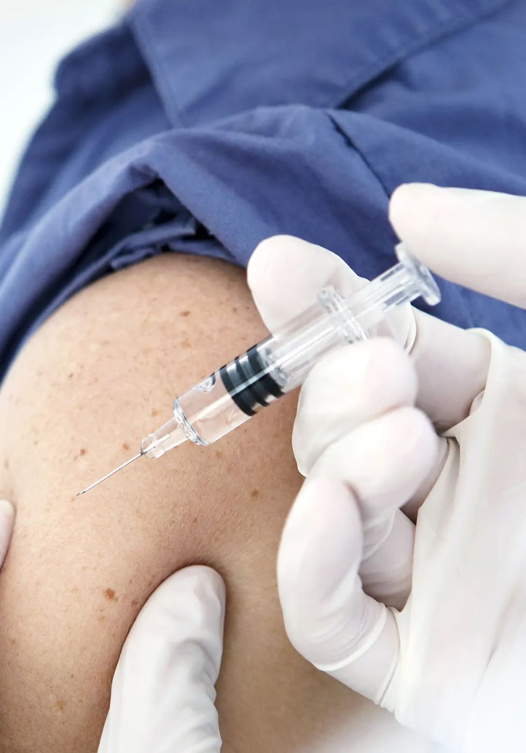 2925 P-Shot for Men: winter park regenerative medicine