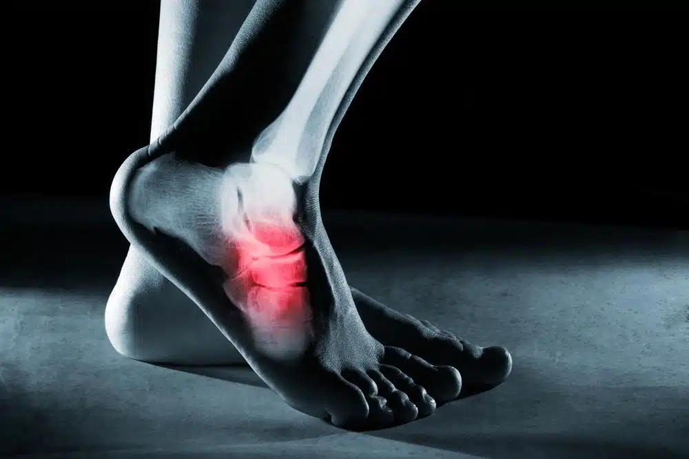 Ankle And Foot Pain
