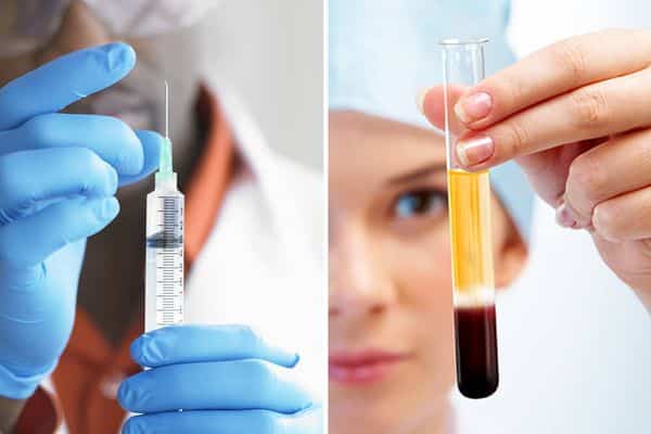Stem Cell Injections Stem Cell Injections
