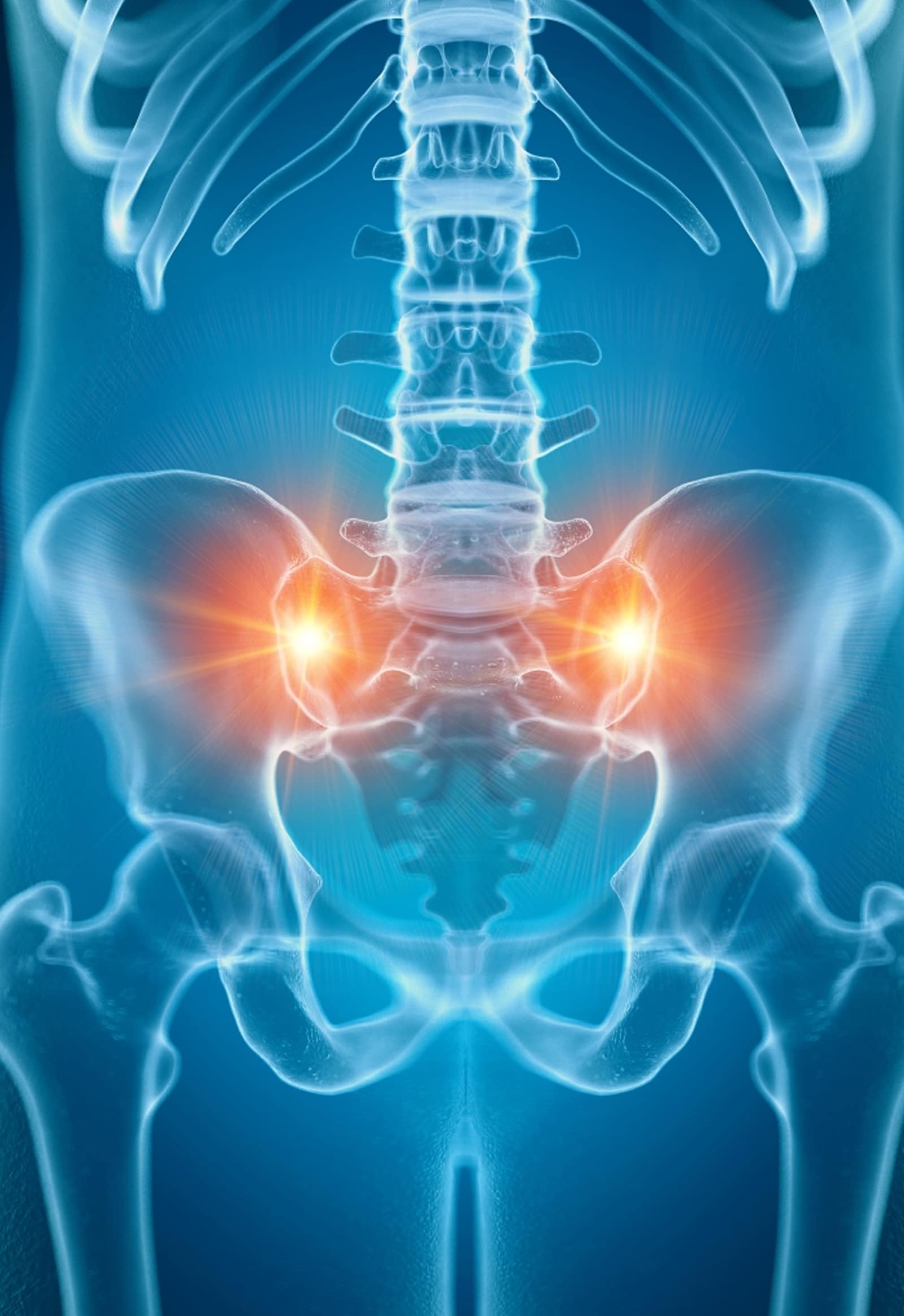 Sacroiliac Joint Dysfunction Sacroiliac Joint Dysfunction