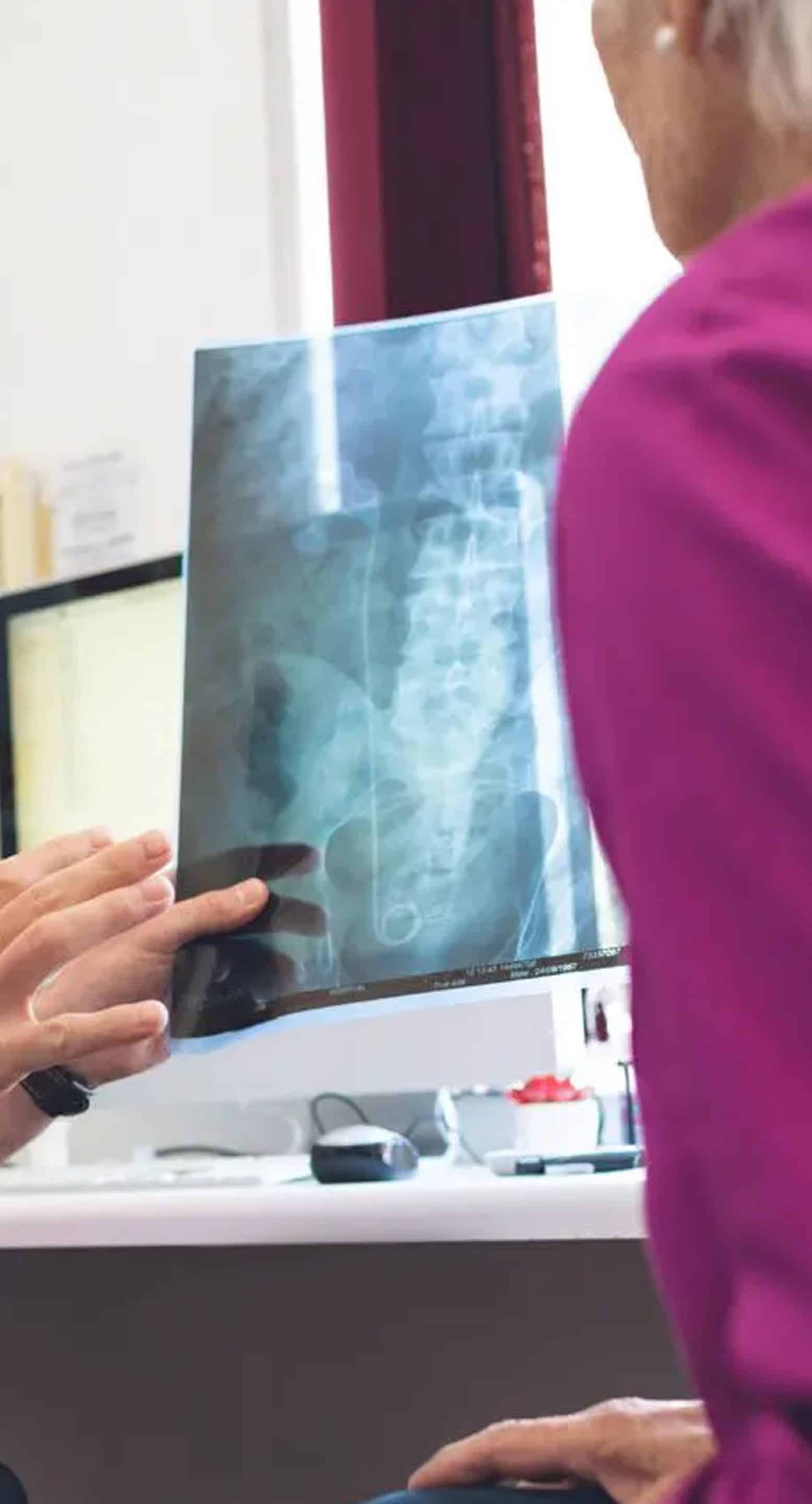 Sacroiliac Joint Pain Treatment Sacroiliac Joint Pain Treatment