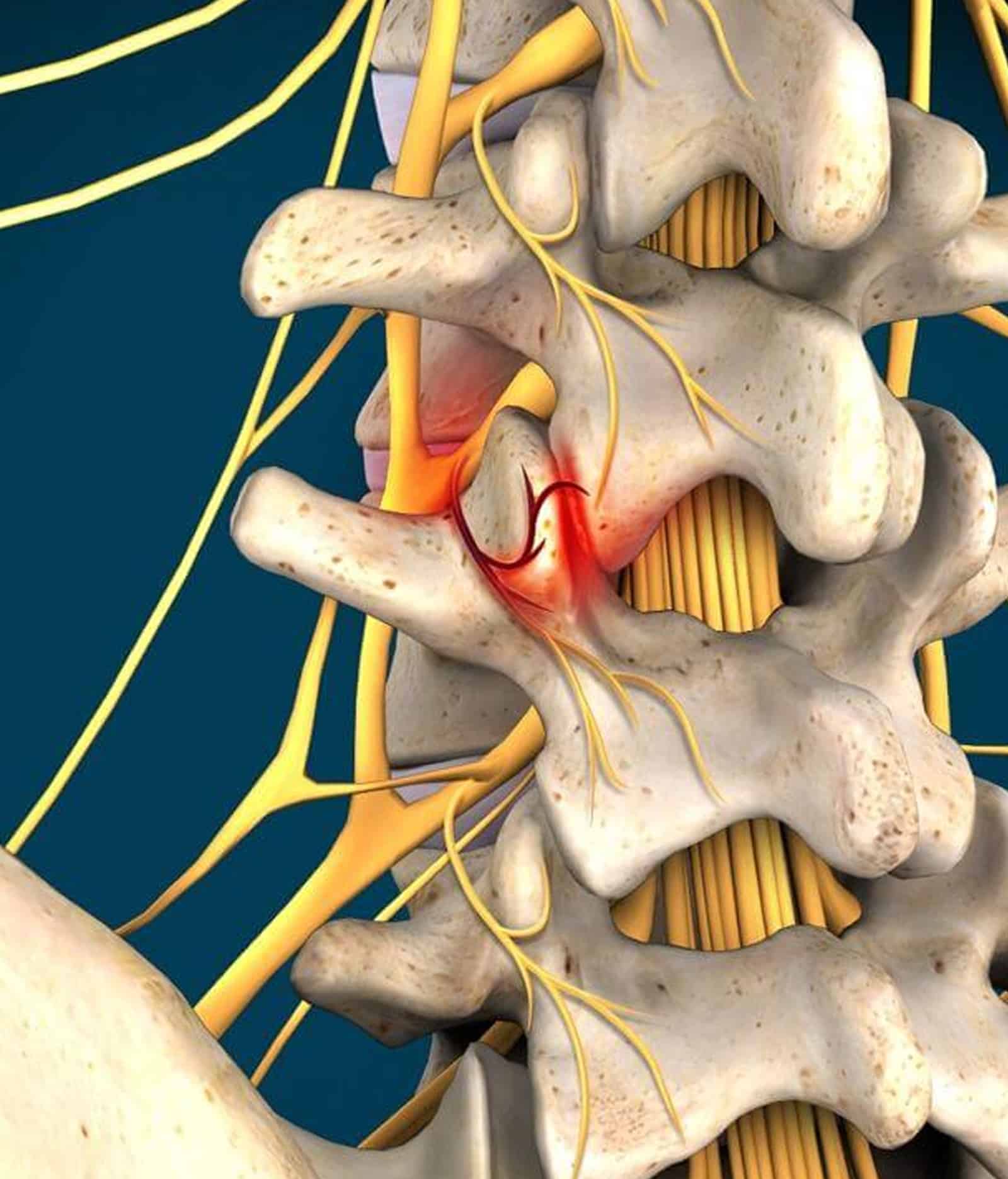 Facet Joints Facet Joints