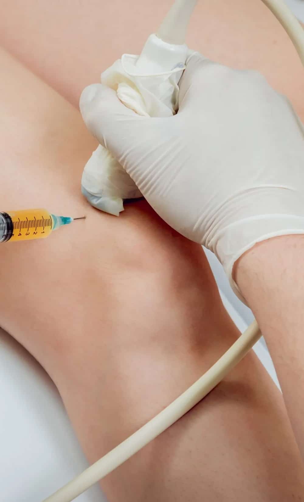 Prolotherapy Benefits Prolotherapy Benefits
