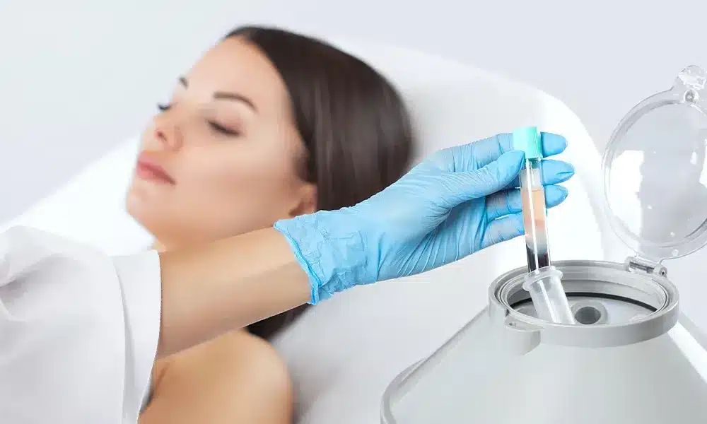 Platelet Rich Plasma (PRP) Florida