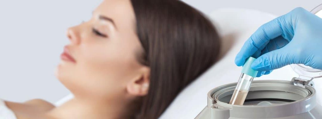 Platelet Rich Plasma (PRP) Florida