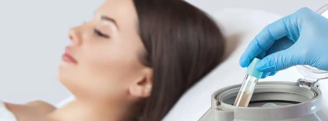 Platelet Rich Plasma (PRP) Florida