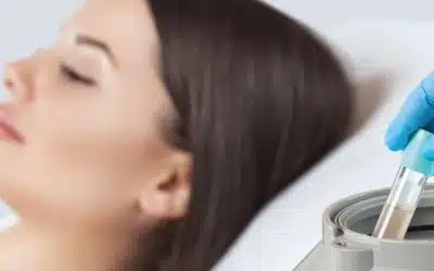 Platelet Rich Plasma (PRP) Florida – Natural Healing