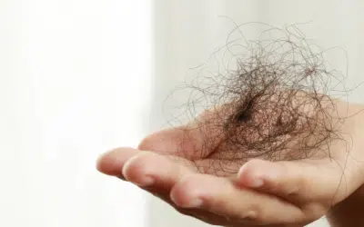 Hair Restoration In Orlando Fl