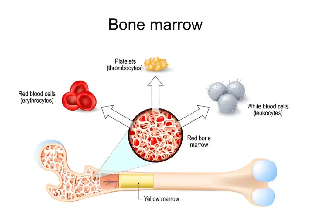 Bone Marrow Aspirate Concentrate
