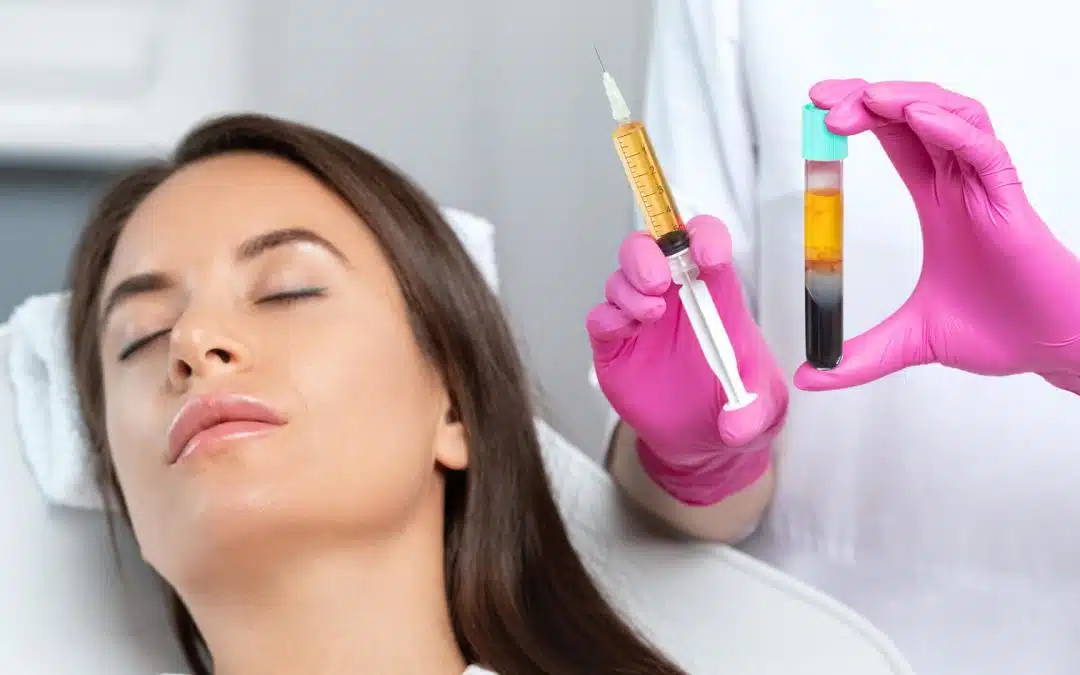 PRF Injections for Hair Loss