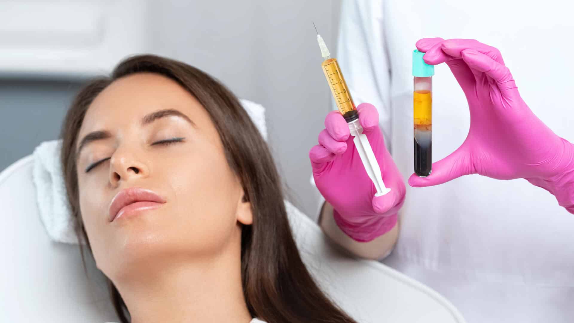 PRF Injections for Hair Loss