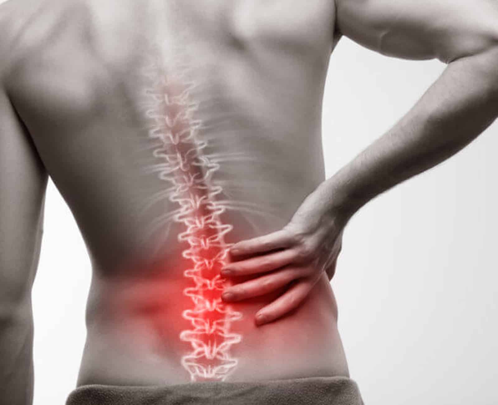 Facet Joint Pain
