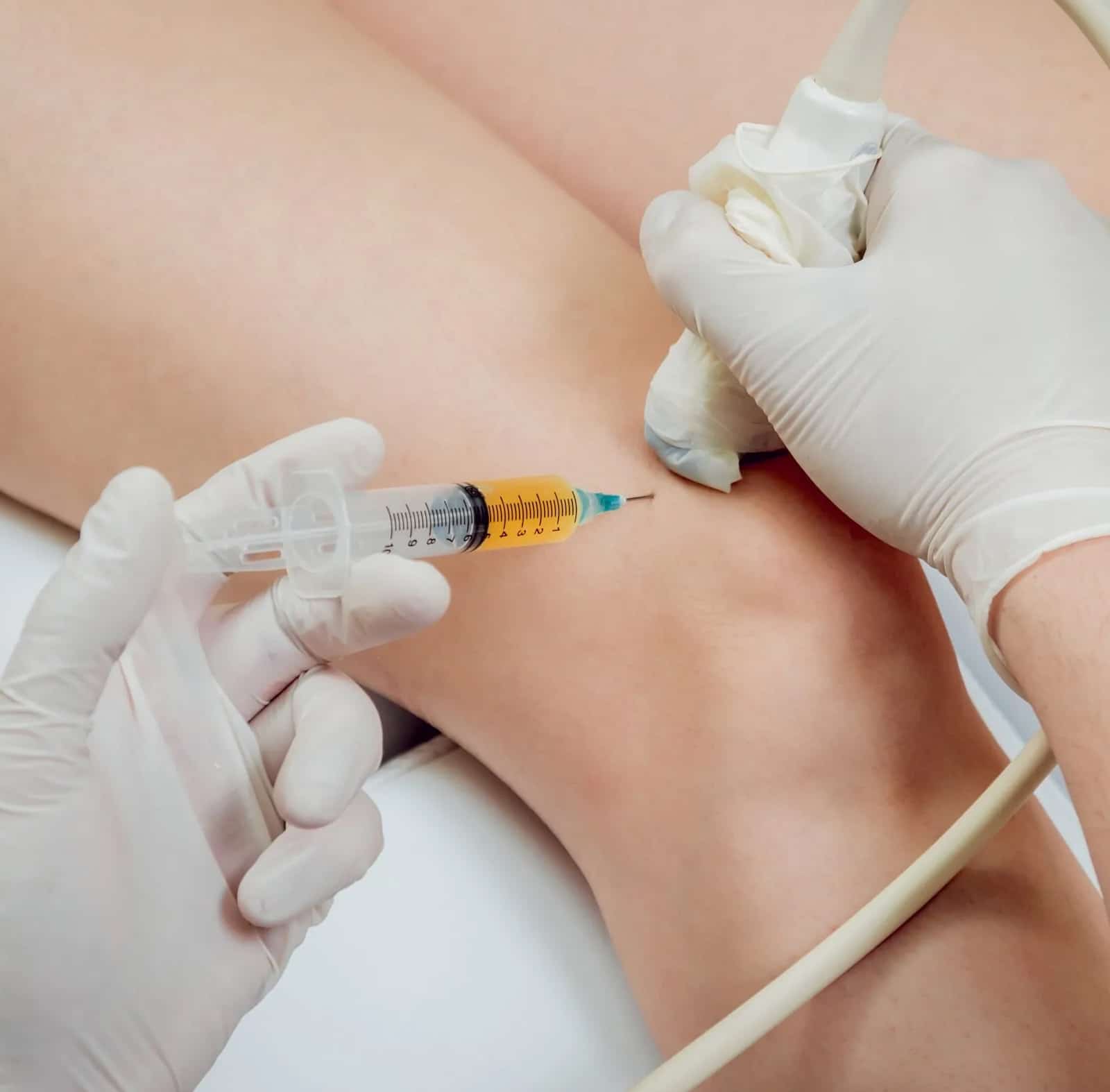 Prolotherapy