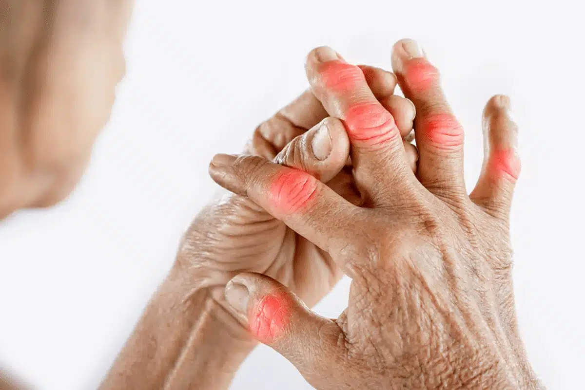 Emerging Options (2)