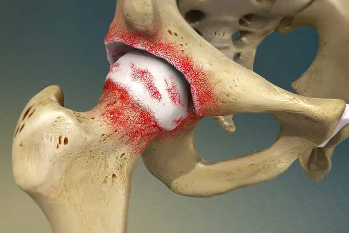 New therapies like cannabinoids