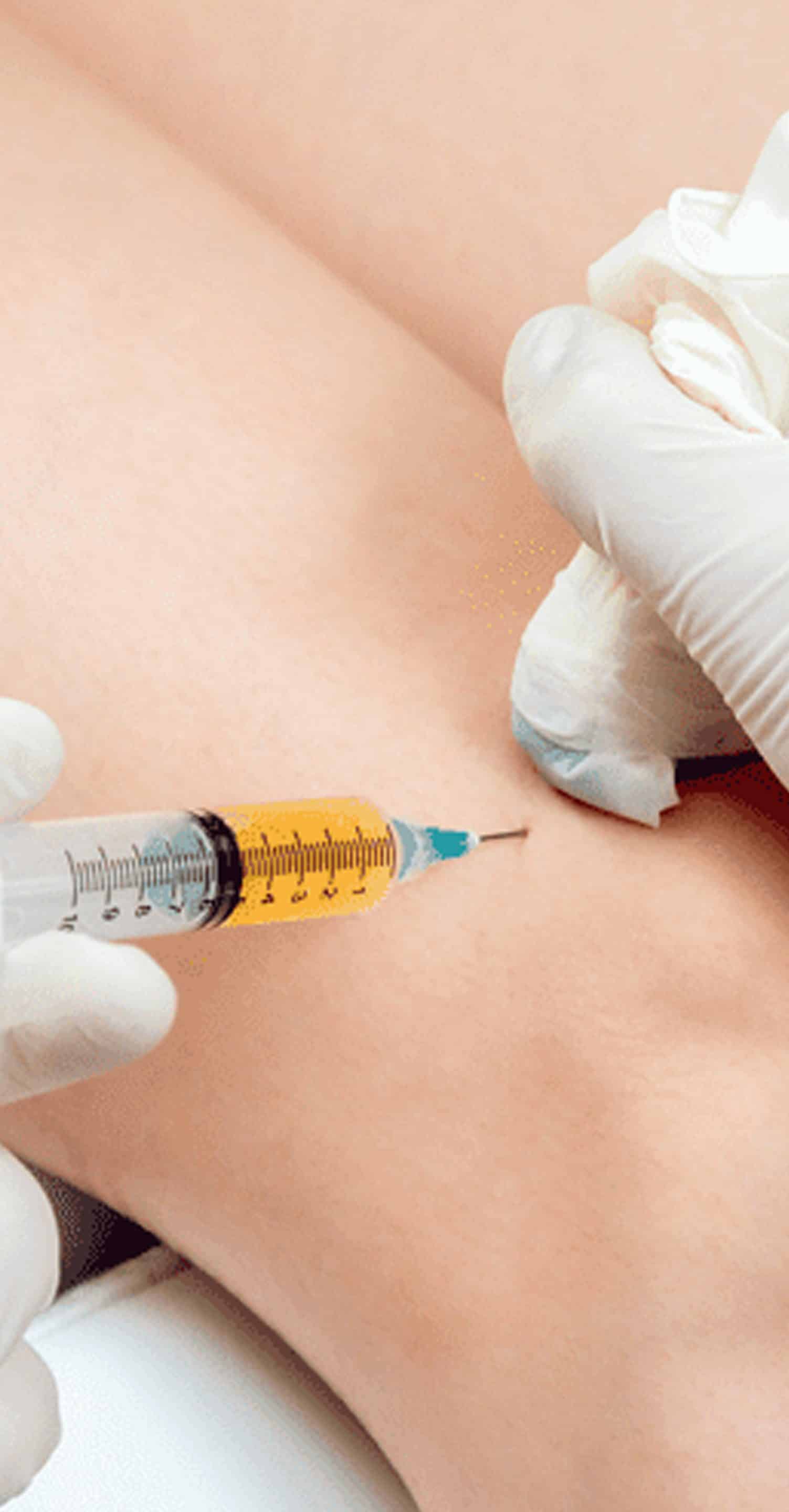 O-Shot Appointment O-Shot Appointment