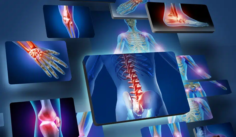 Sports Injuries Treatment