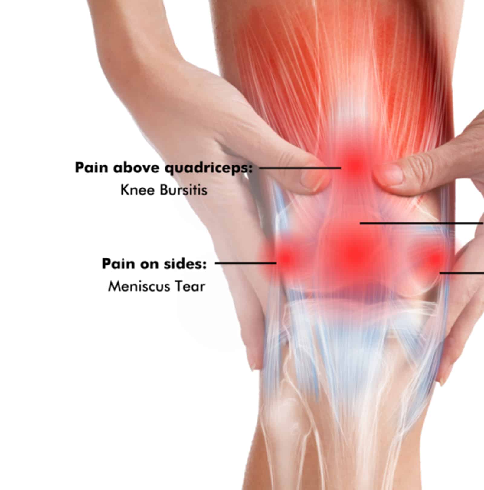 Toward Pain-Free Movement Today Toward Pain-Free Movement Today