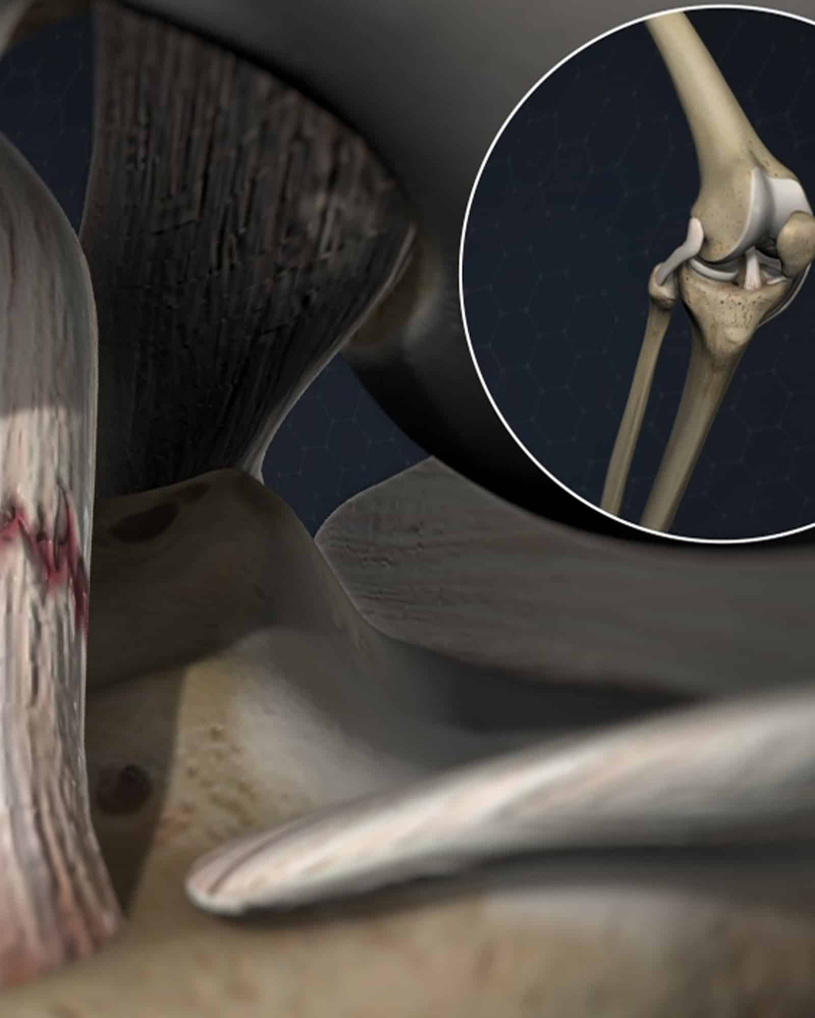 Diagnosis of Ligament Injuries Diagnosis of Ligament Injuries