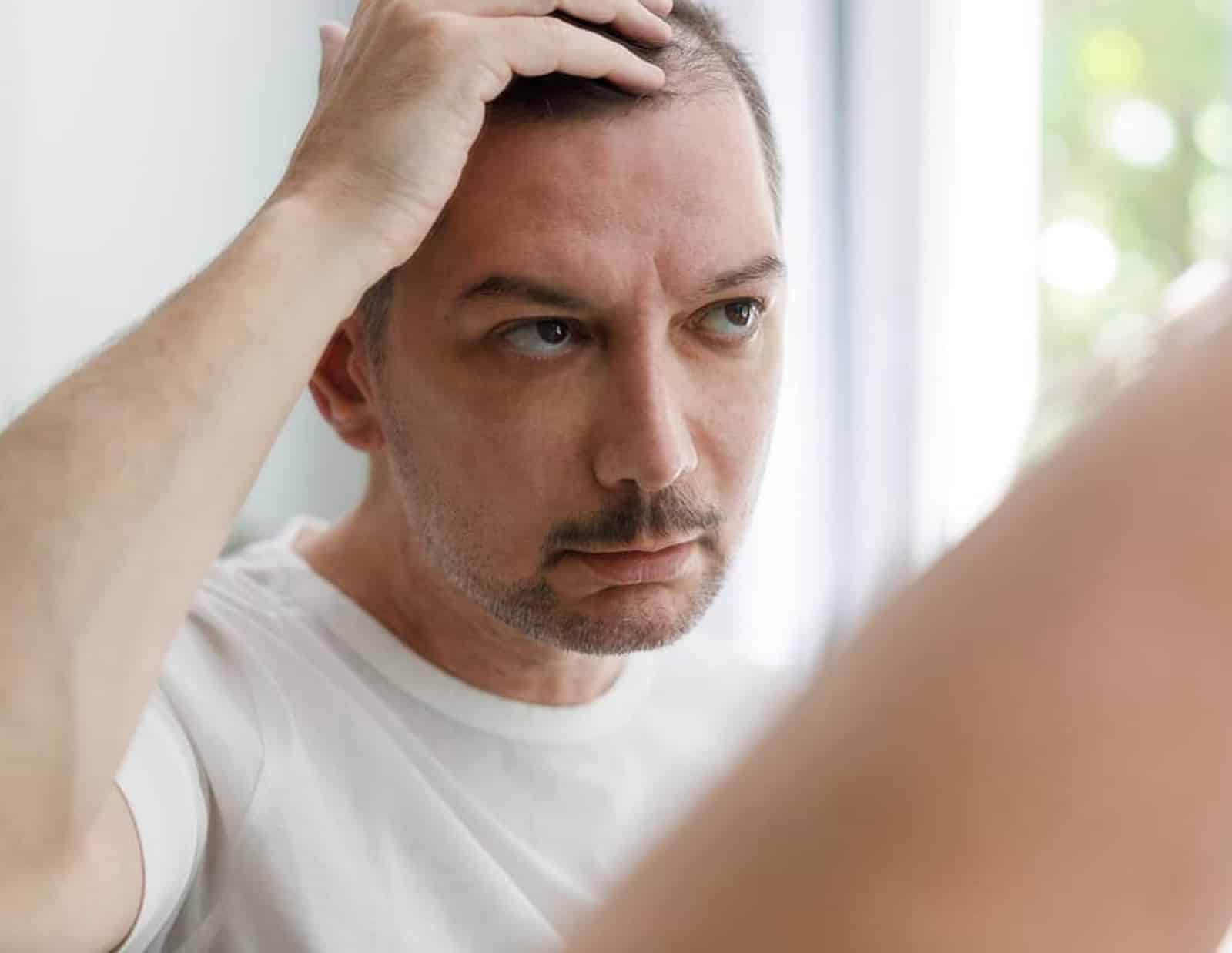 Hair Restoration and Transplant Options Hair Restoration and Transplant Options