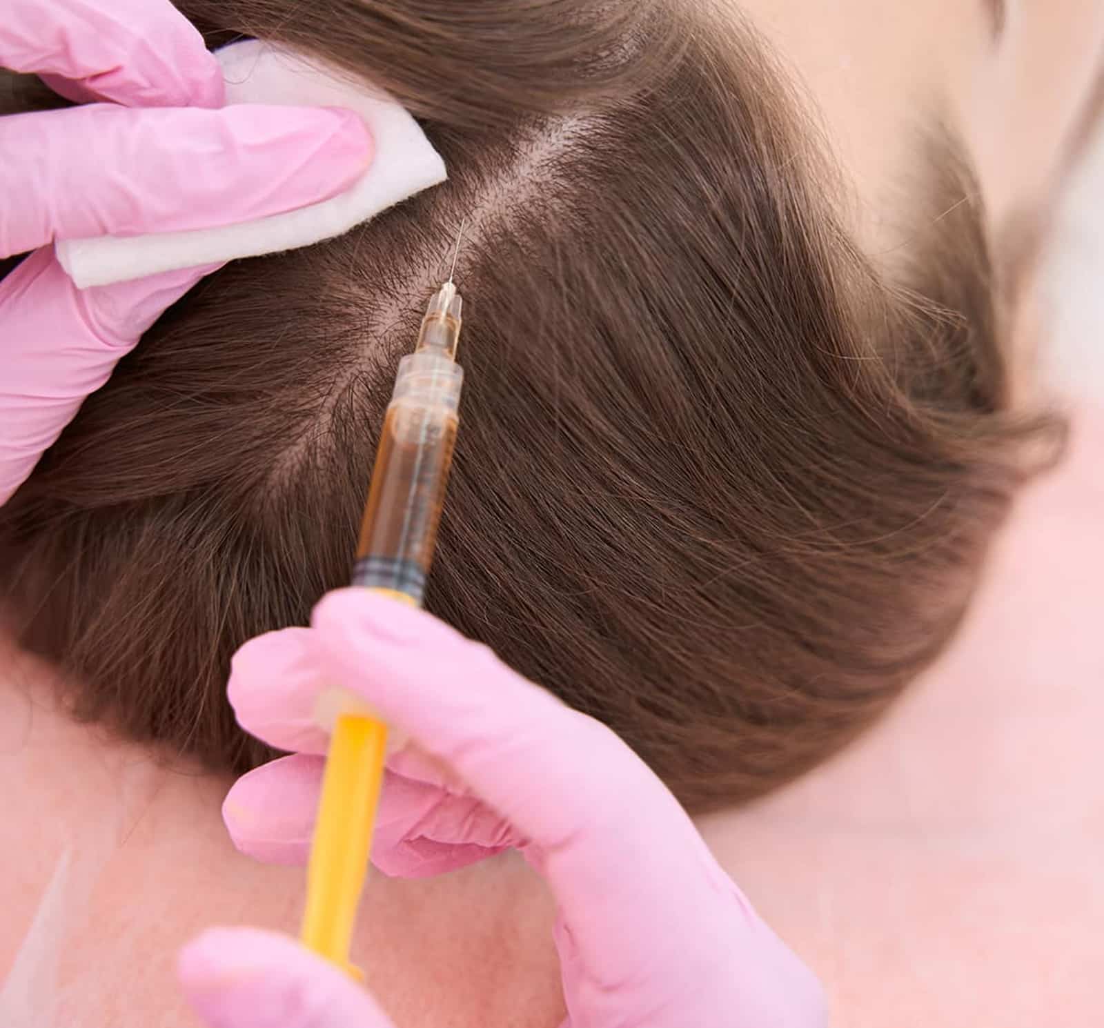 Long-Term Hair Restoration Solution Long-Term Hair Restoration Solution