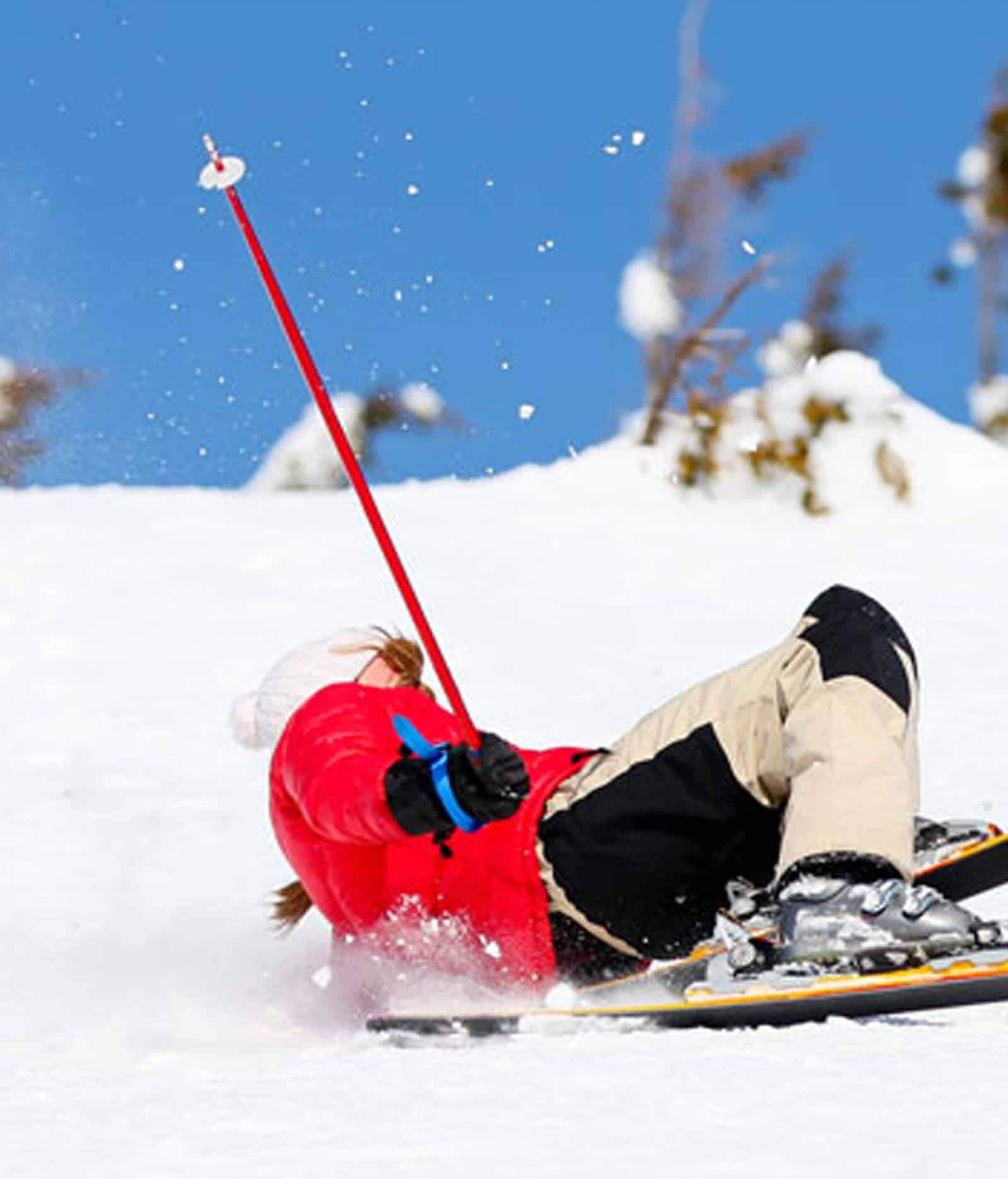Types of Ligament Injuries Symptoms of Ligament Injuries