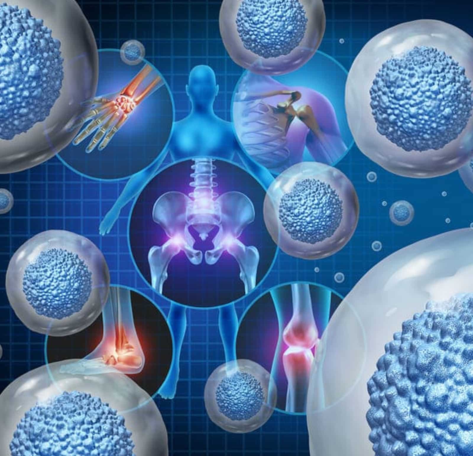 Stem Cell Therapy