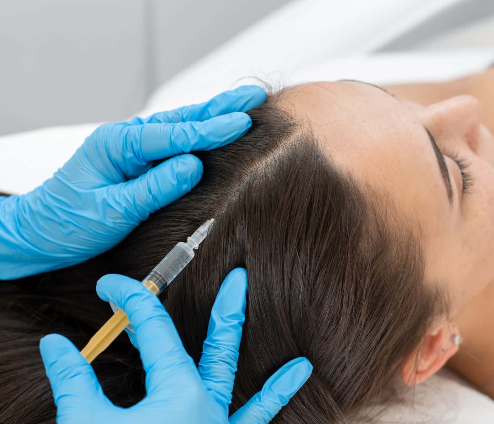Consultation and Scalp Assessment