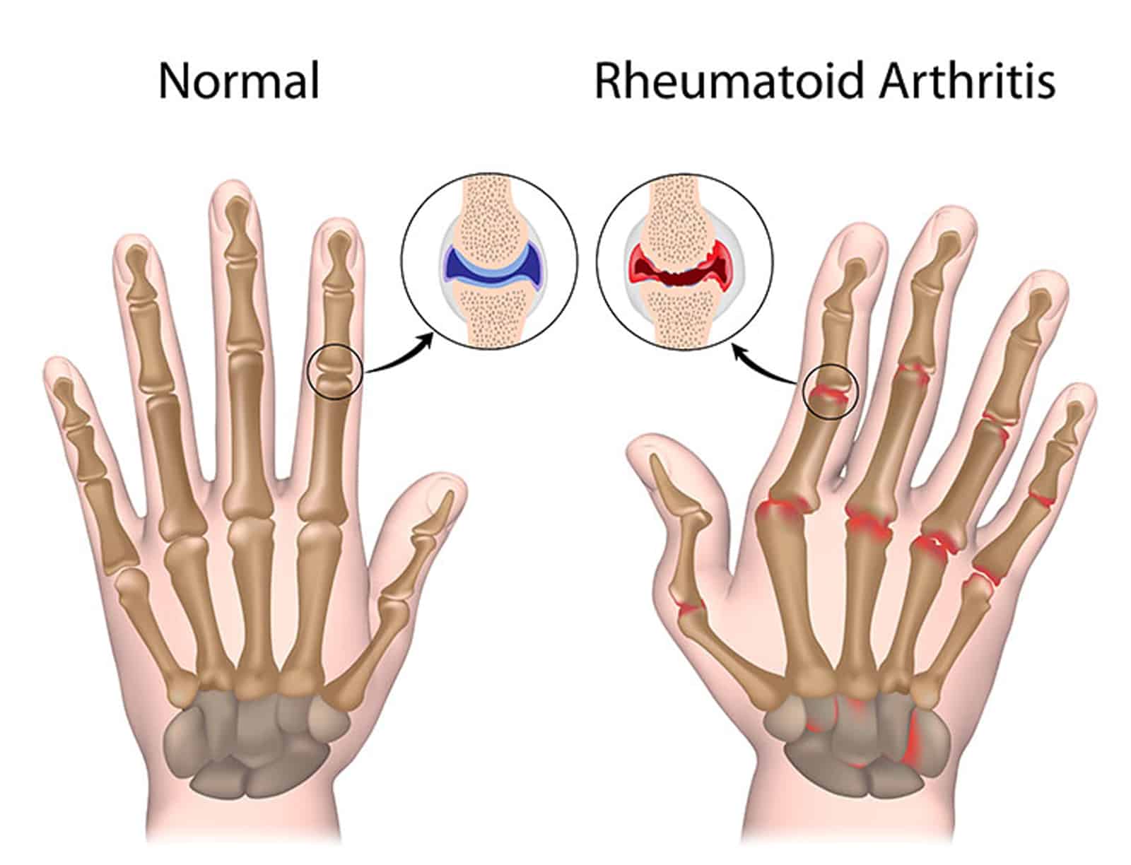 Conventional Treatments Conventional Treatments