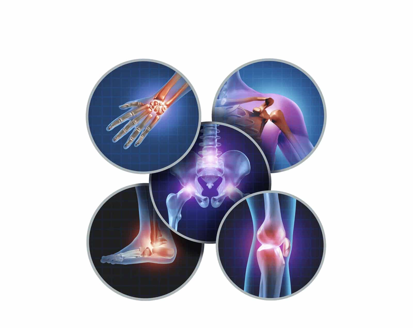 Limitations of Conventional Treatments Limitations of Conventional Treatments