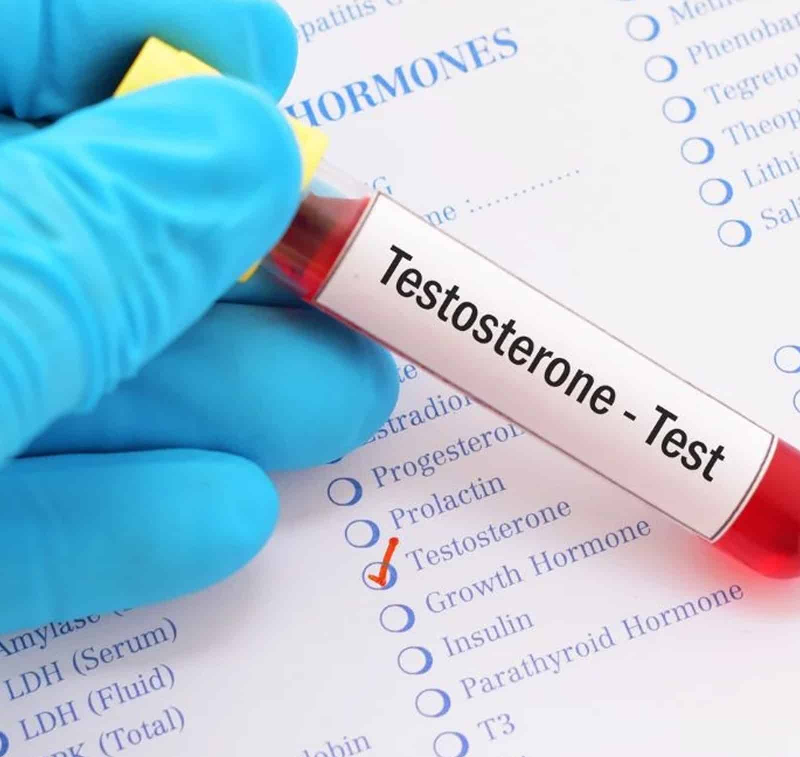 Testosterone Injections