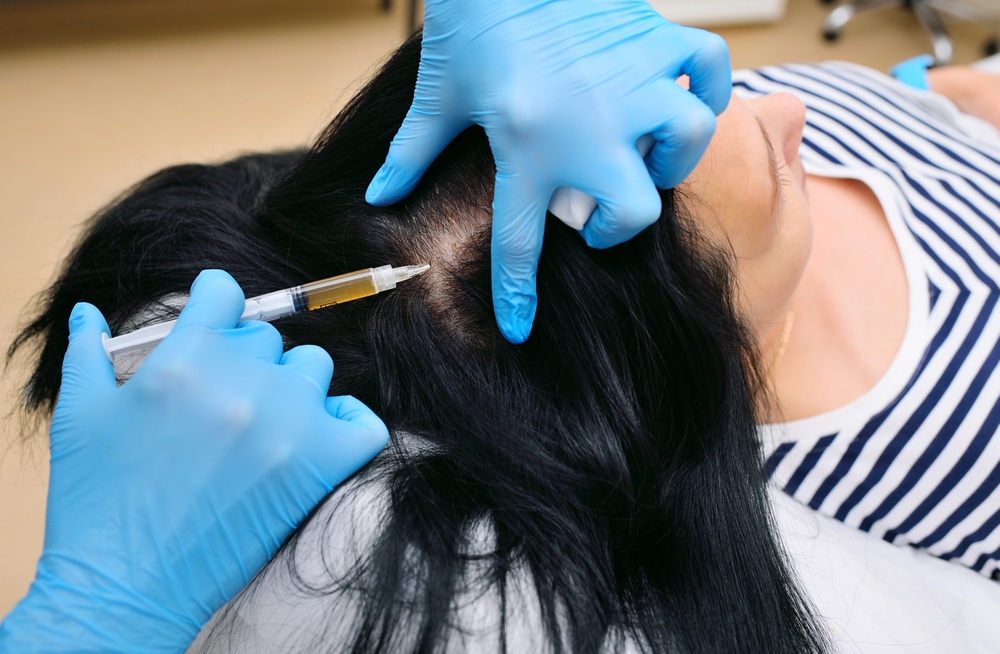 hair restoration winter park