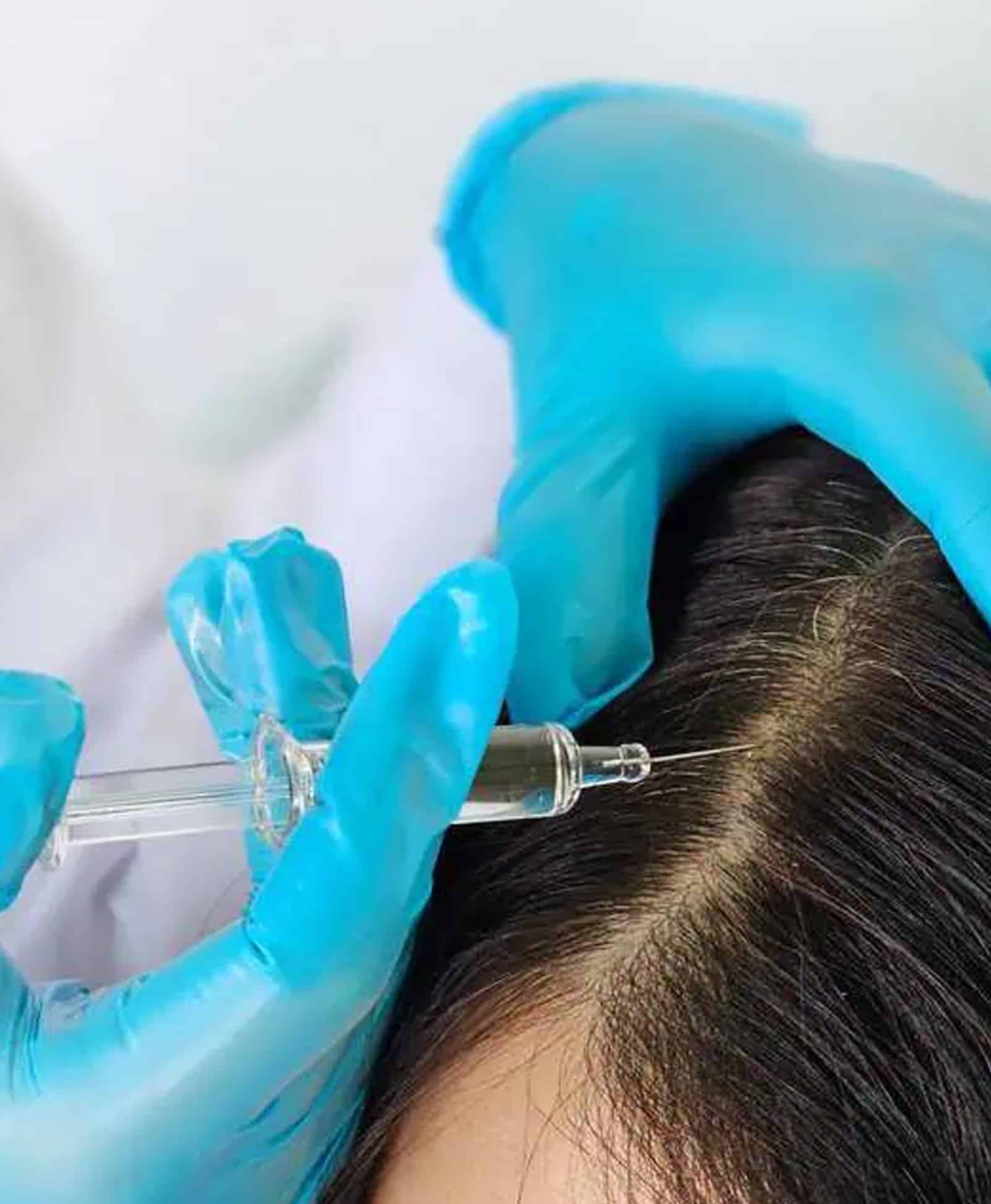 Becoming a Preferred Hair Loss Treatment Becoming a Preferred Hair Loss Treatment