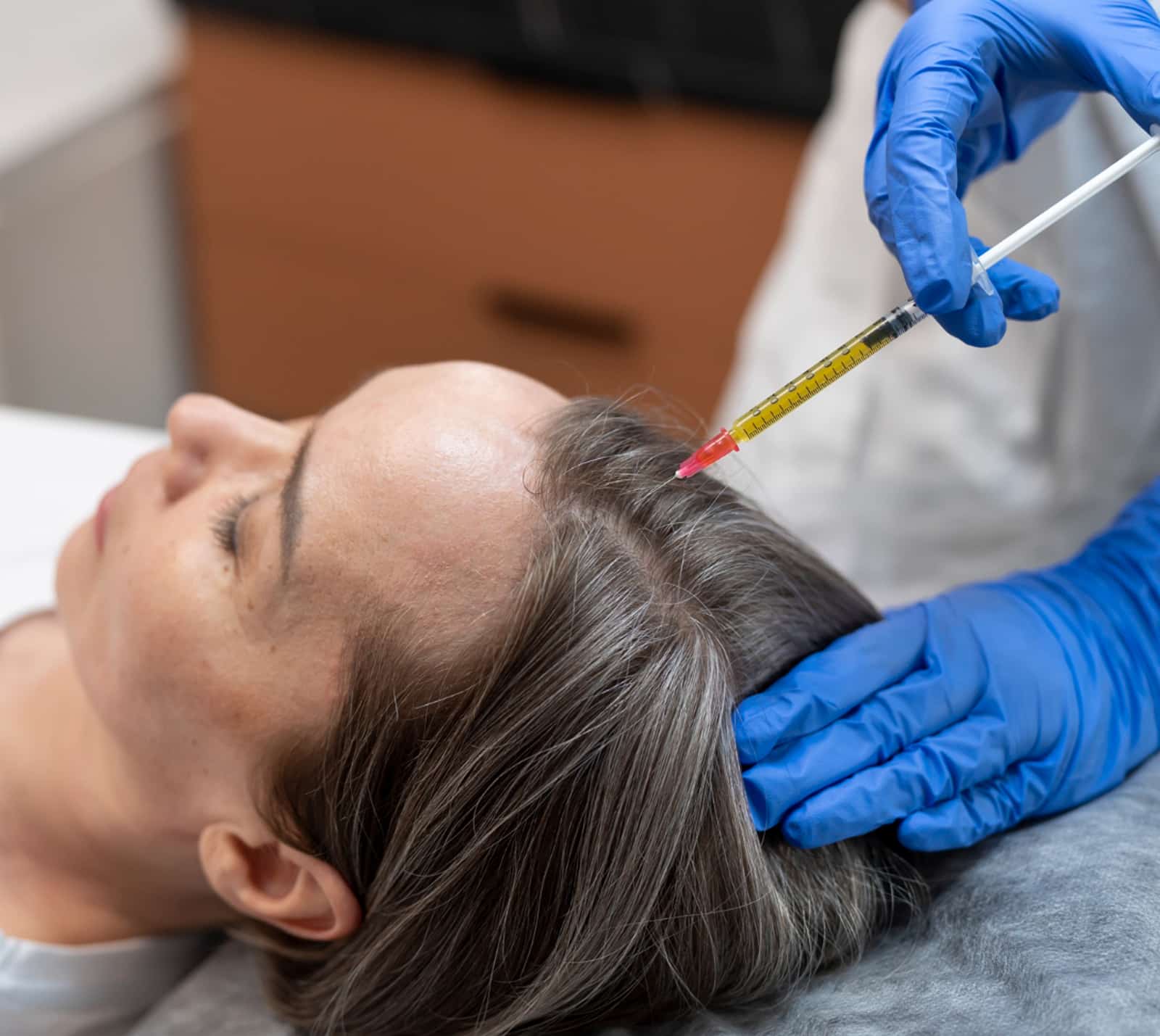 Expect During a PRF Hair Restoration Session Expect During a PRF Hair Restoration Session