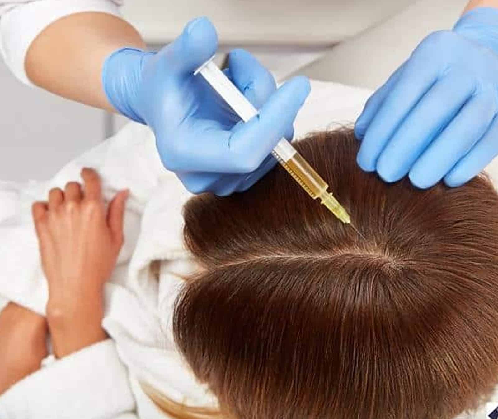 Hair Regrowth with Combination Therapies Hair Regrowth with Combination Therapies
