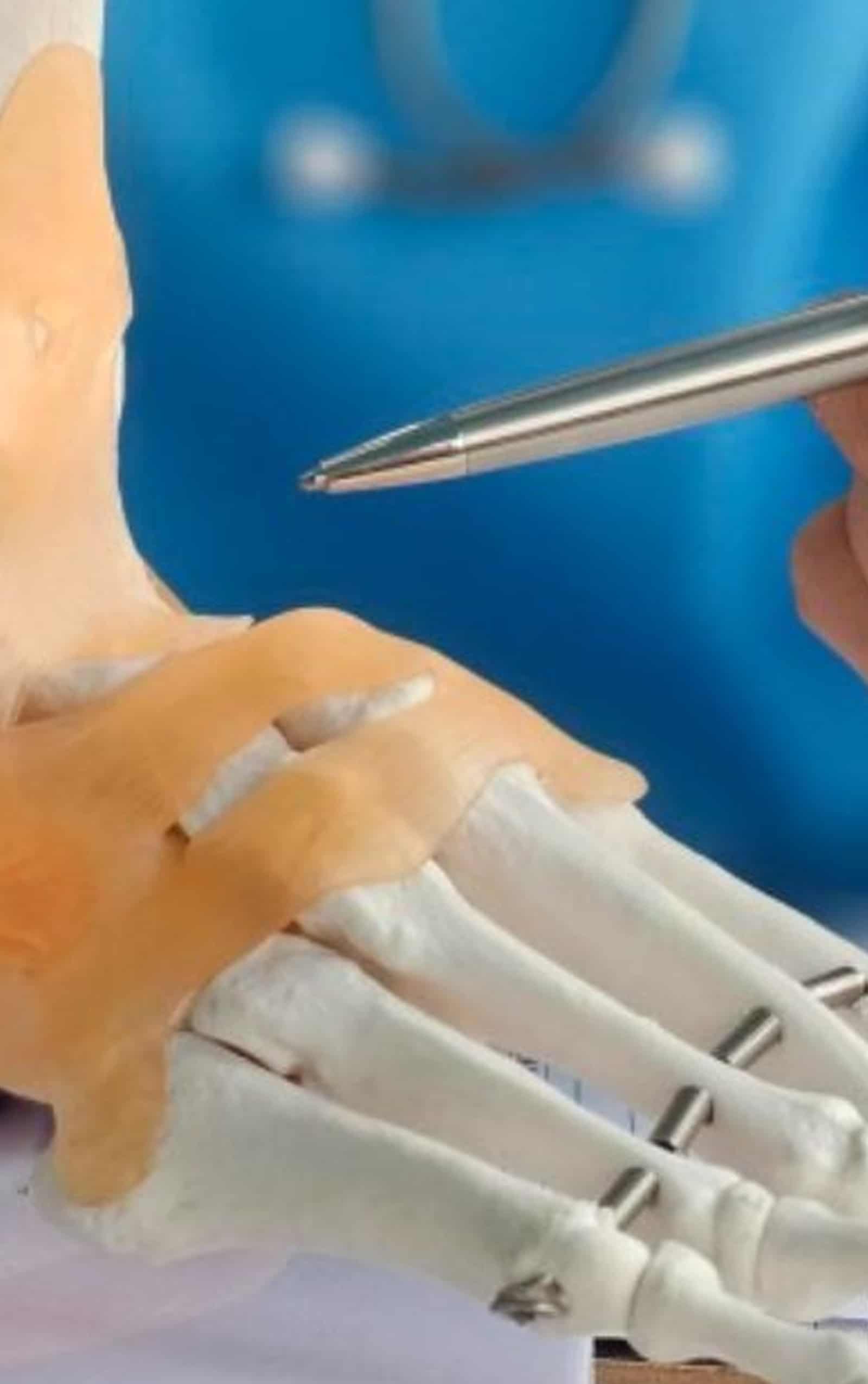 Sports Injury Recovery Sports Injury Recovery