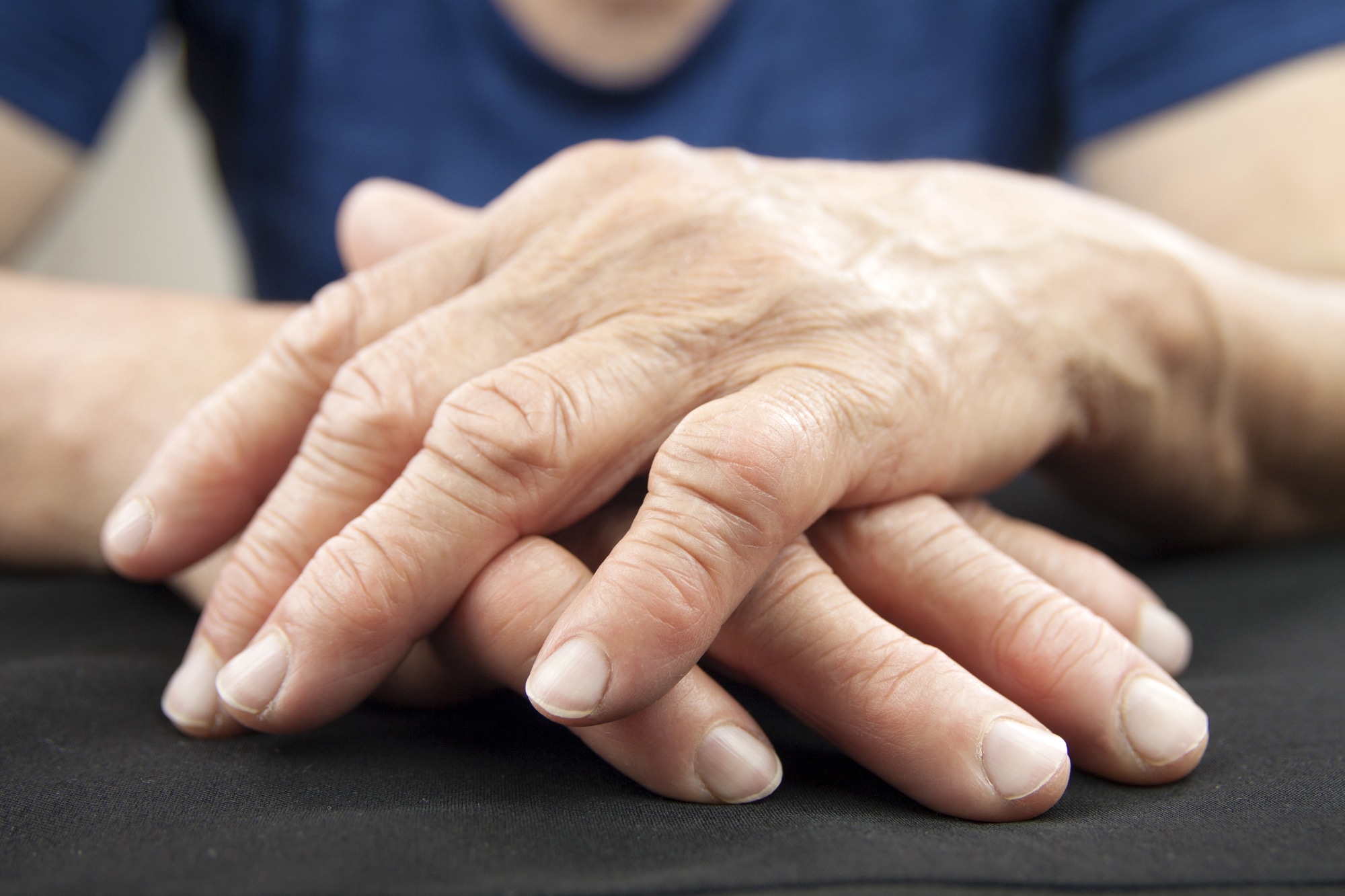 osteoarthritis treatment orlando
