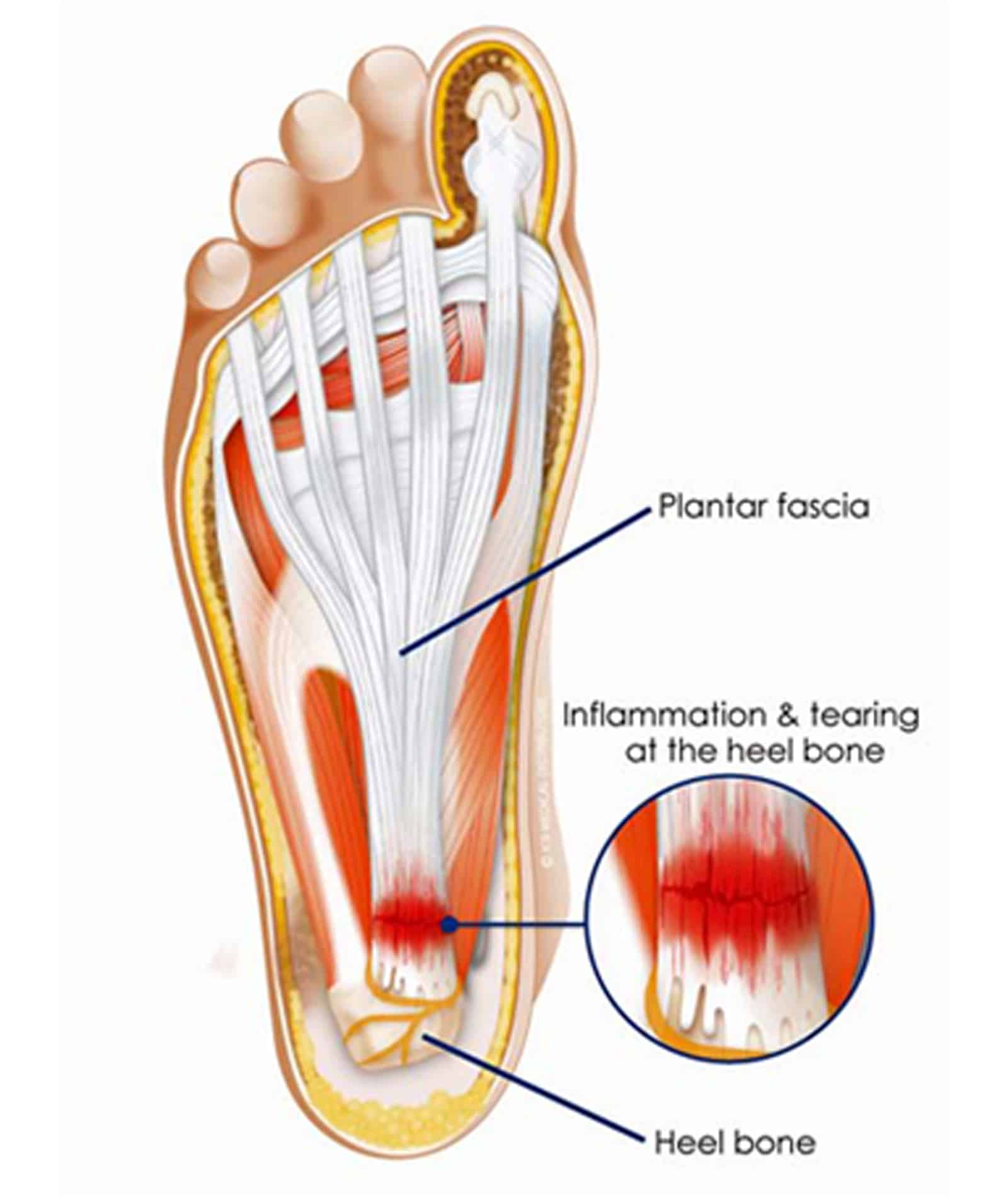 Different Levels of Ligament Injury Severity Different Levels of Ligament Injury Severity