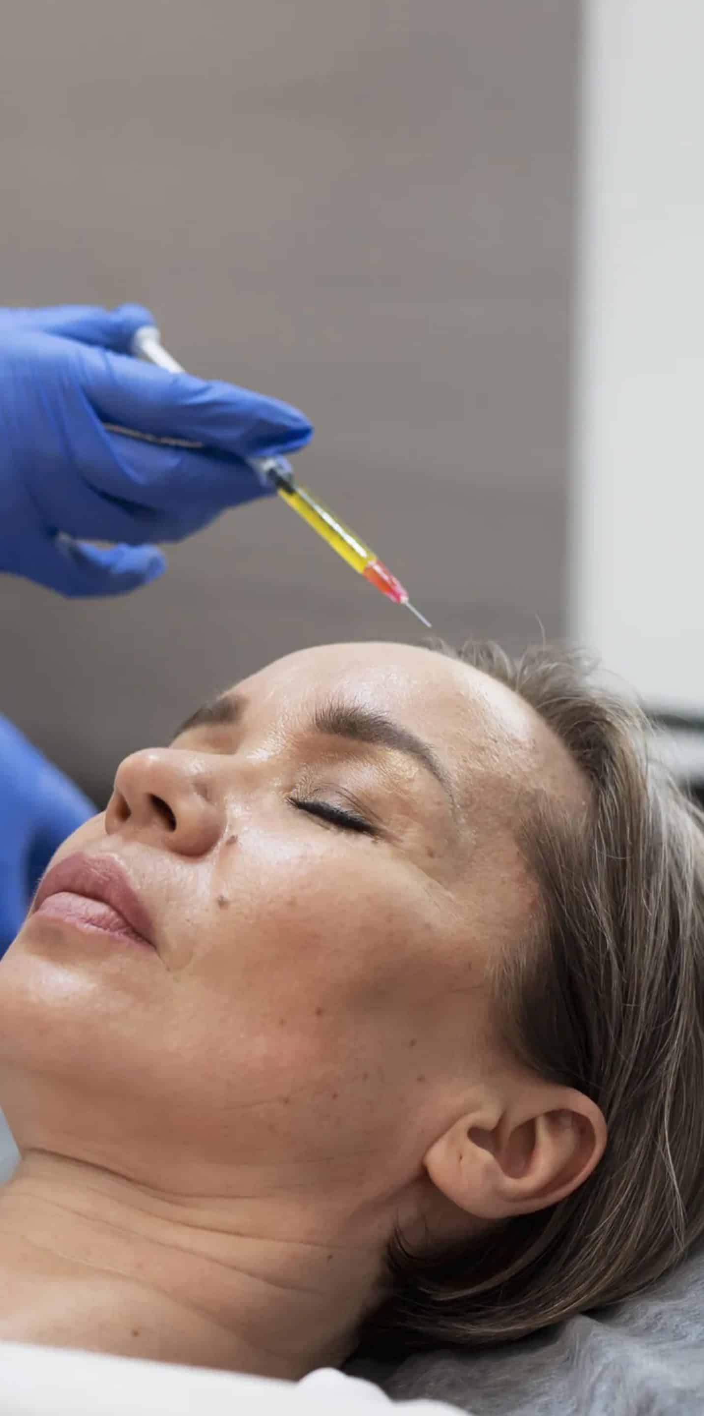 Treated with Exosome Therapy Treated with Exosome Therapy