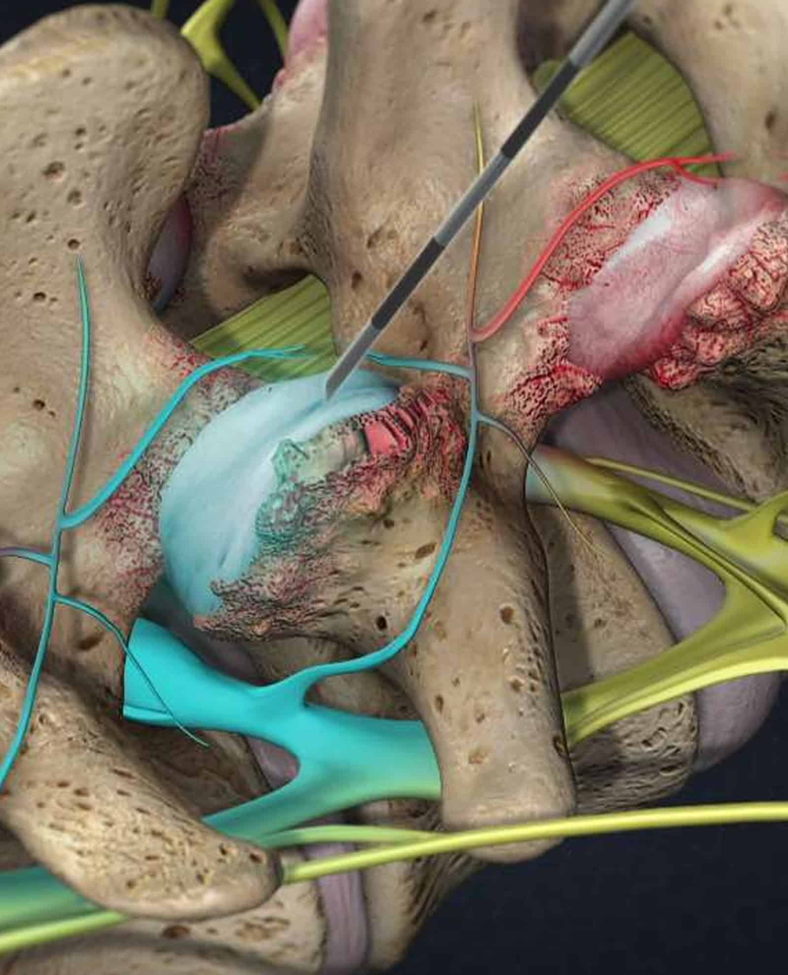 Facet Joints in Spinal Health Facet Joints in Spinal Health