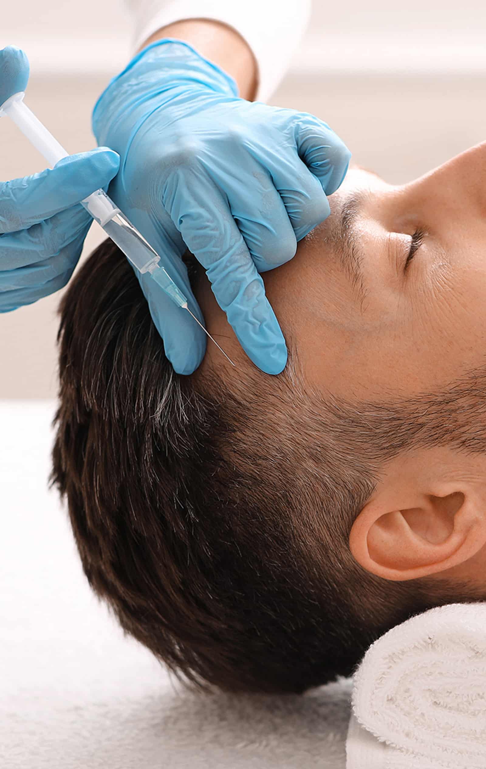 Hair Growth Timeline After PRF Therapy PRF Injections for Hair Loss