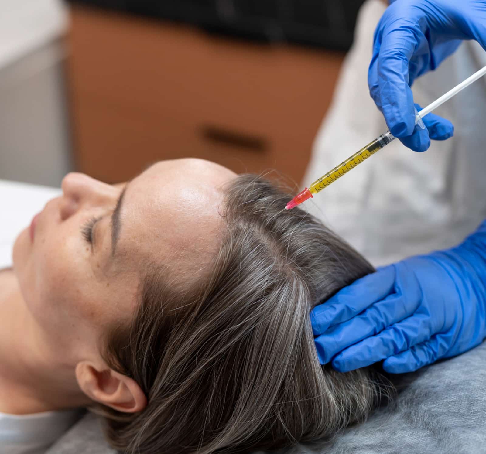 Hair Thinning and Shedding