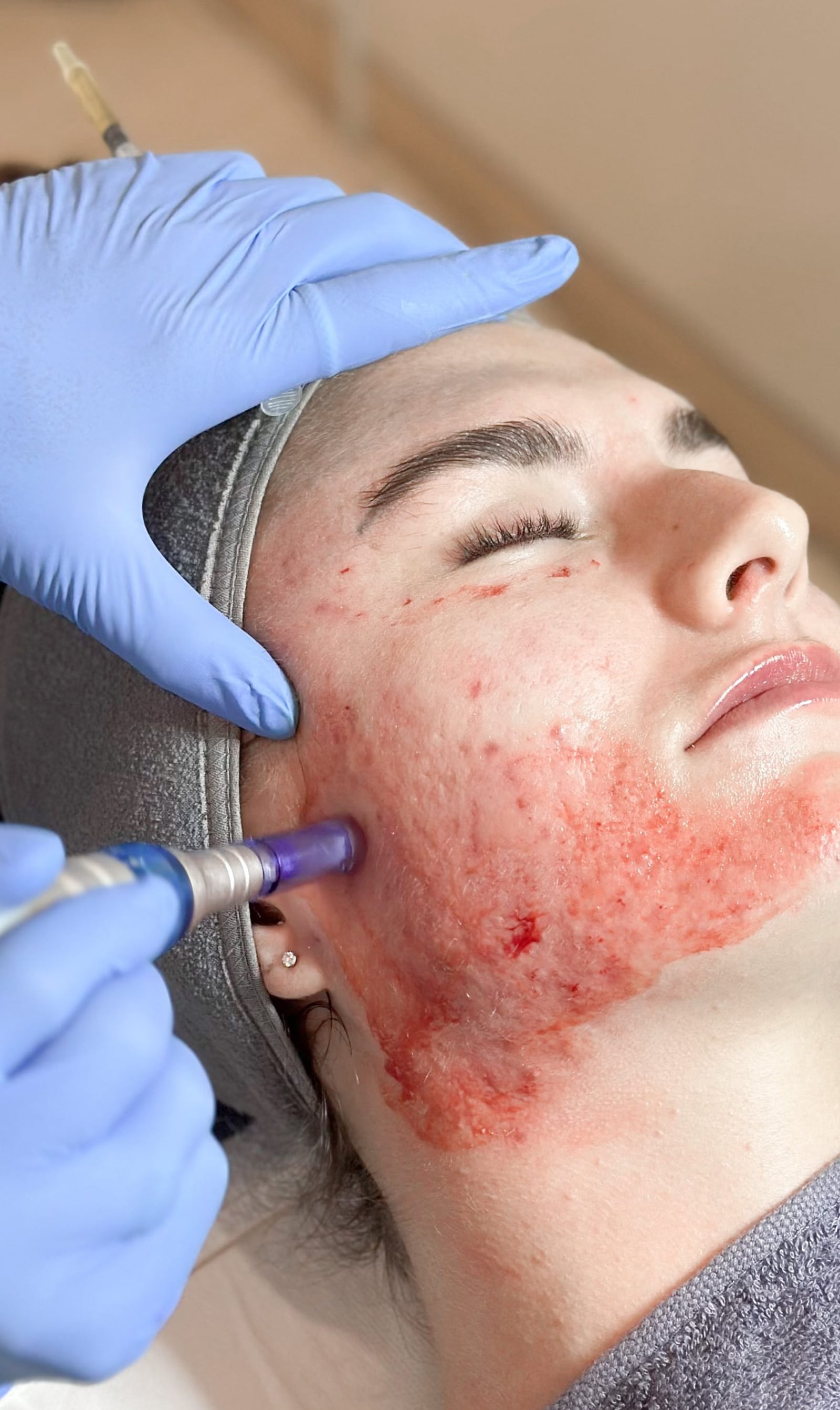 Stimulate natural healing mechanisms