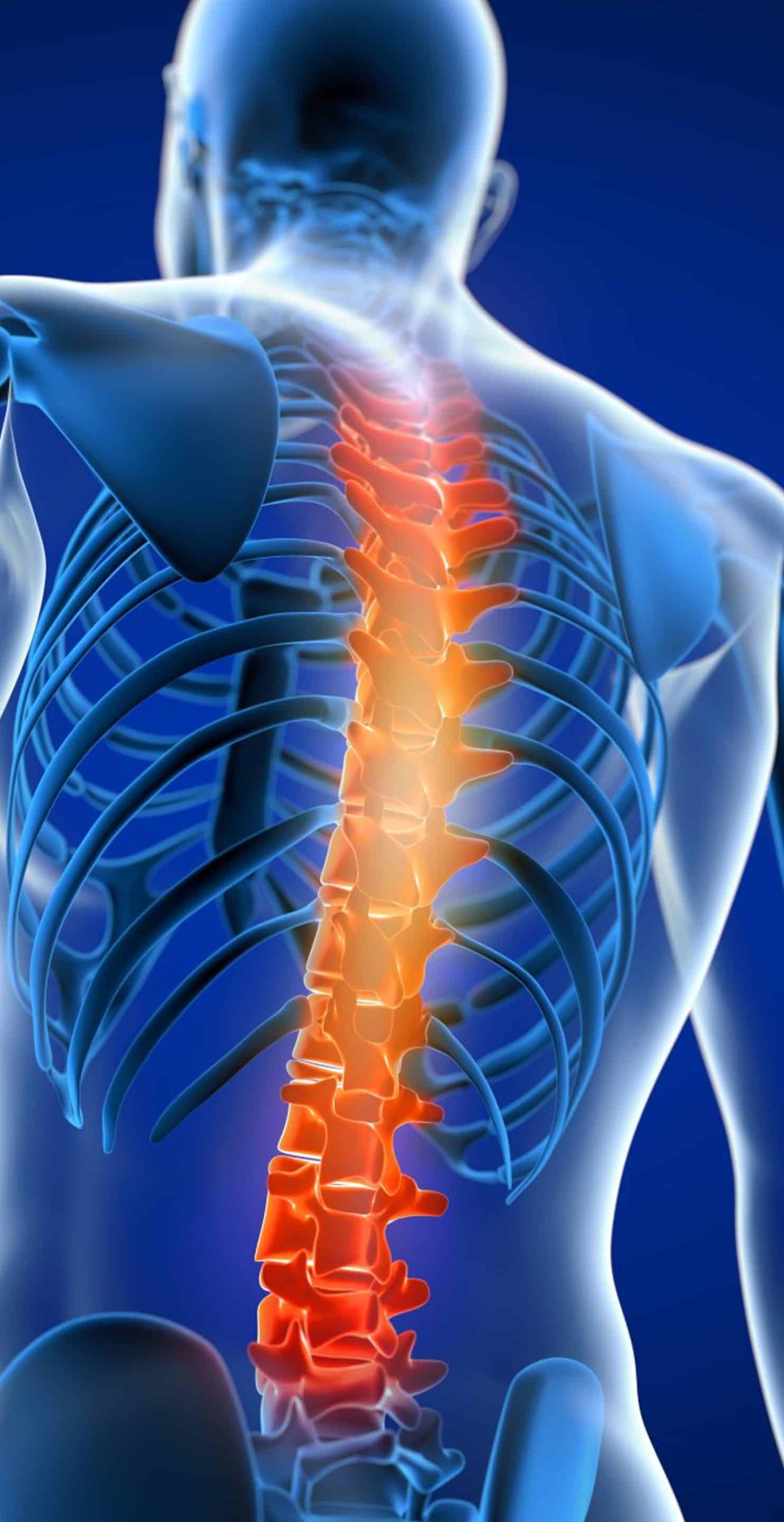 Underlying Reasons Behind Facet Joint Degeneration Facet Joints