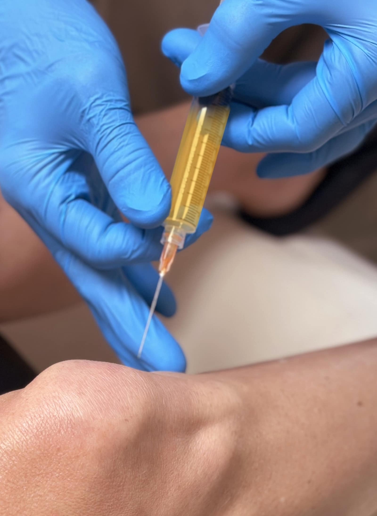 Advanced PRP Injections at Winter Park Regenerative Medicine Facet Joints