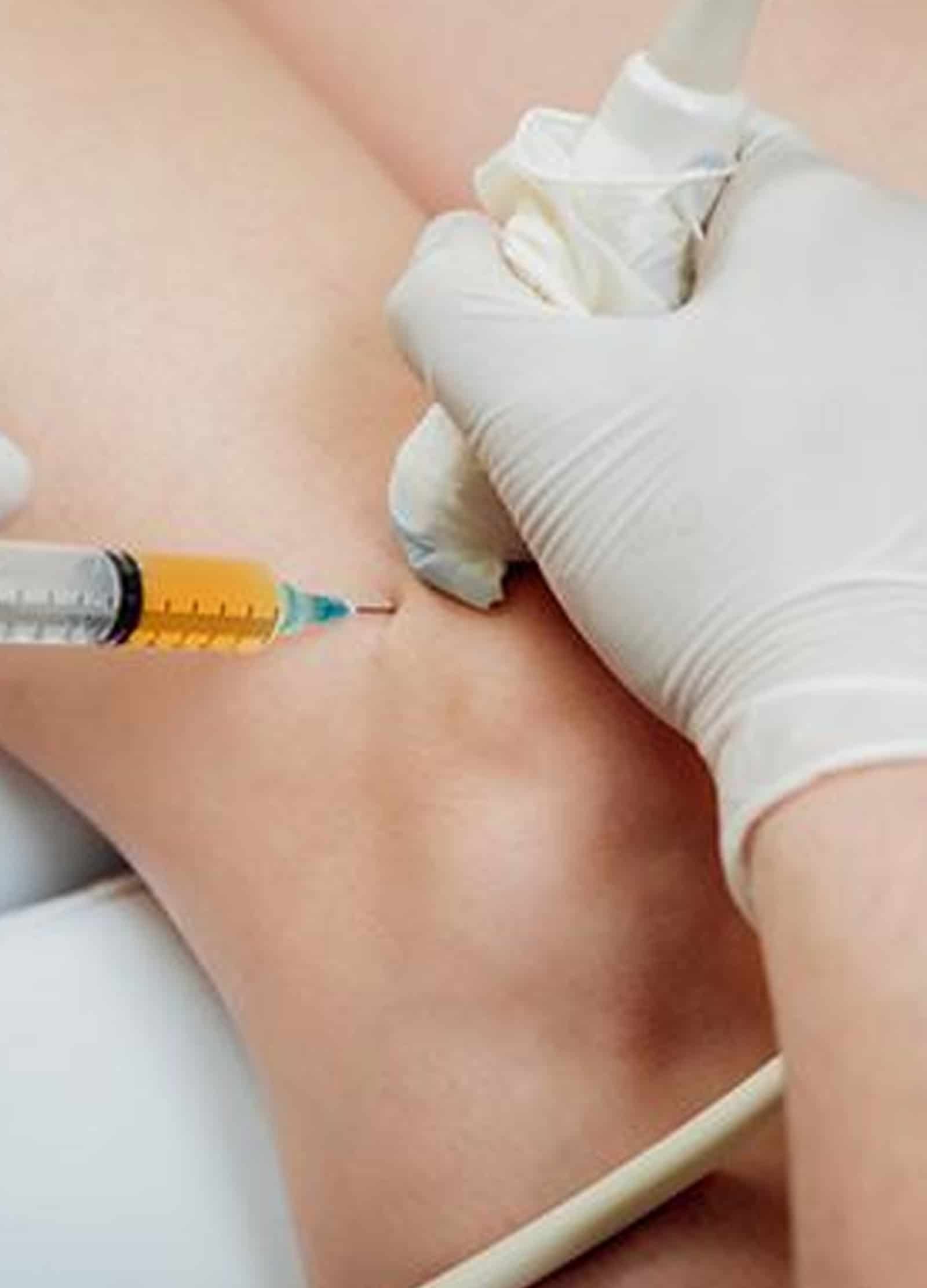 Facet Joint Pain Winter Park Signs of Facet Joint Pain