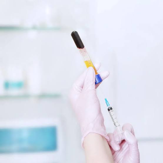 prp vs cortisone injections for joint pain: which is better for long-term healing?