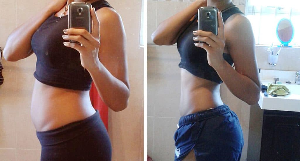 semaglutide weight loss winter park